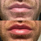 LumaGlow Lip Serum Plumper – serum powiększające usta w kilka minut