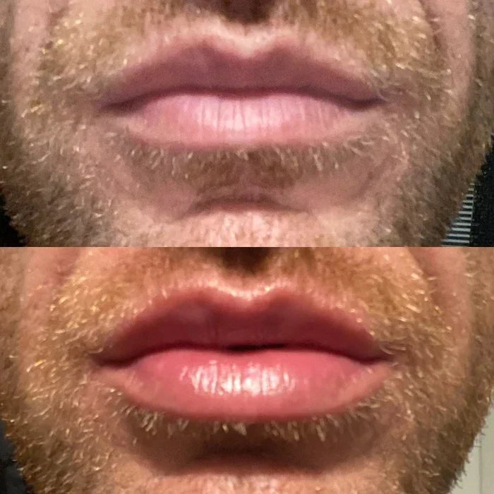 LumaGlow Lip Serum Plumper – serum powiększające usta w kilka minut