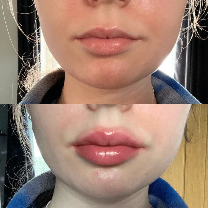 LumaGlow Lip Serum Plumper – serum powiększające usta w kilka minut