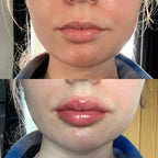LumaGlow Lip Serum Plumper – serum powiększające usta w kilka minut