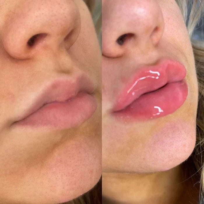 LumaGlow Lip Serum Plumper – serum powiększające usta w kilka minut